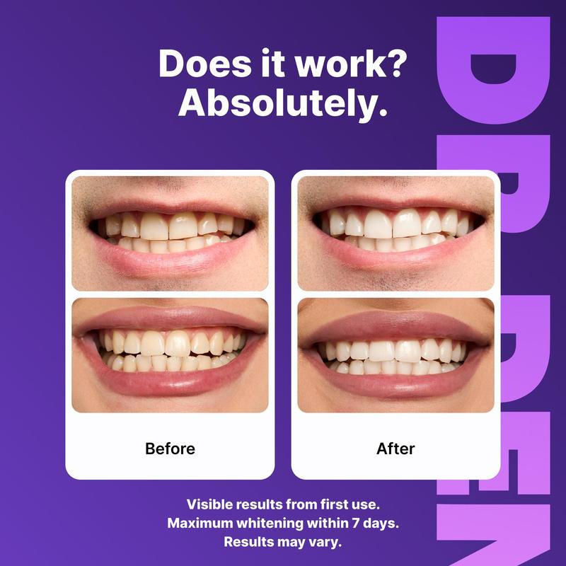 DRDENT Purple Teeth Whitening Strips - 7/21 Whitening Sessions 